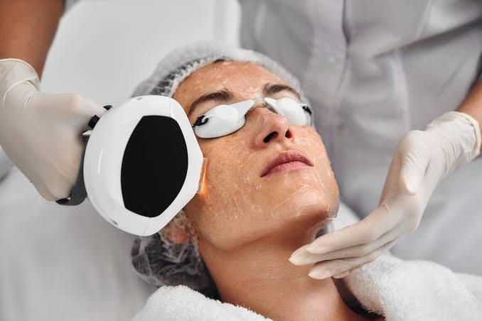 IPL Photofacial