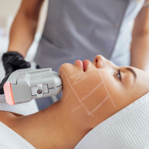 Non-Surgical Facelift (HIFU)