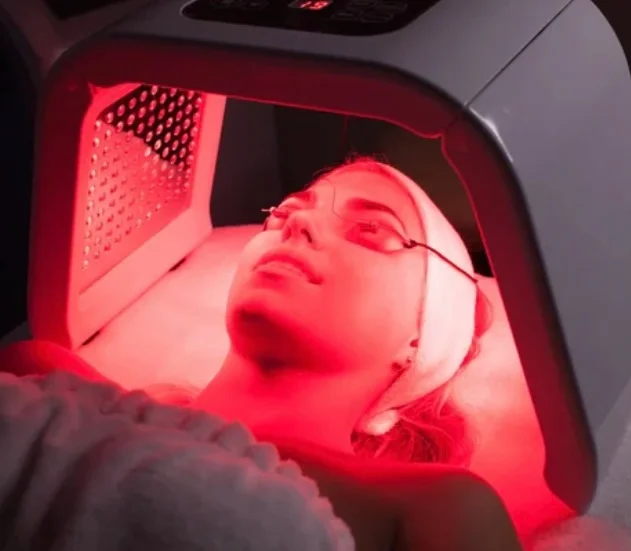 Microneedling with HA and LED treatment